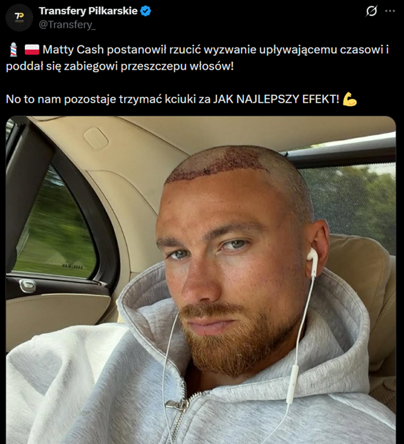 Matty Cash ZROBIŁ PRZESZCZEP WŁOSÓW! Tak teraz wygląda!